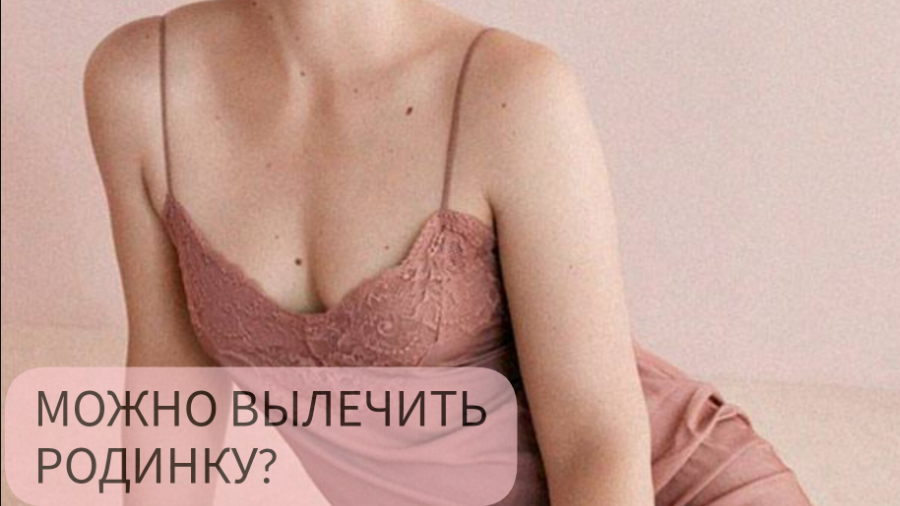 Можно ли вылечить родинку?