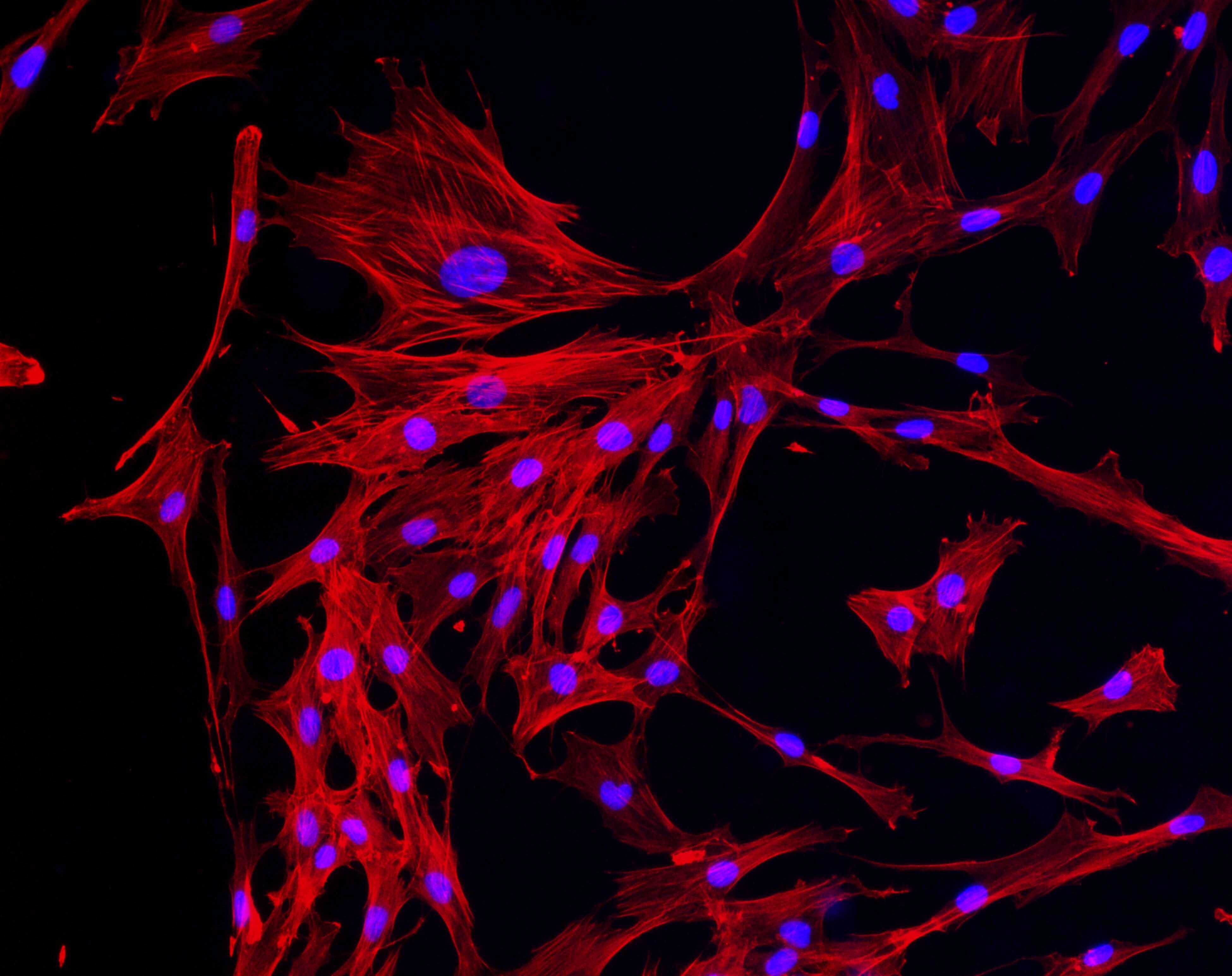 СПРС-терапия
