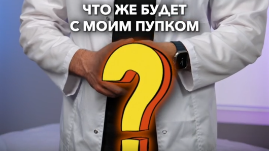 Пупок после абдоминопластики