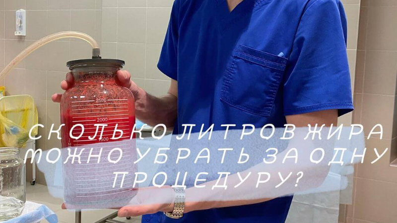 Сколько литров жира можно убрать за одну процедуру?