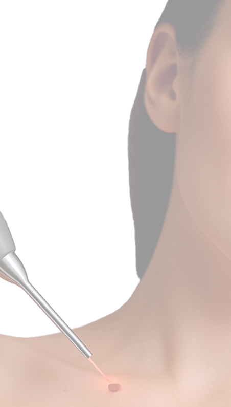 лечение рубцов и шрамов