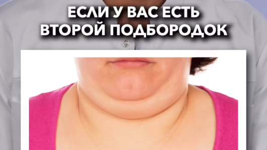 Липосакция второго подбородка - это безрубцовая операция!