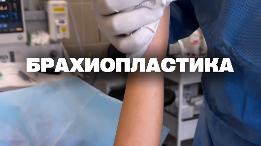 Пациентке выполнил брахиопластику - операцию, которая убирает излишние ткани в районе плеч.