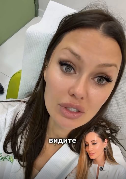 Фулл фейс ботокс с Викторией Боней