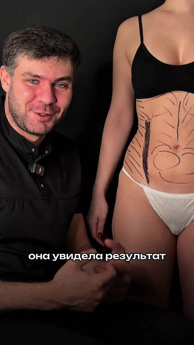 Без перегибов и «перекачанных» форм.