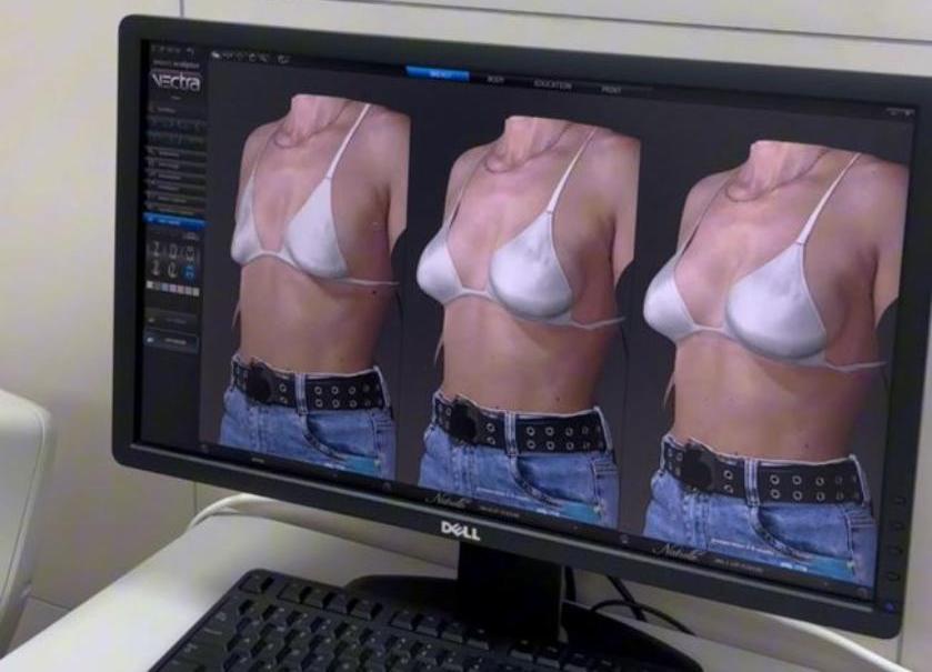 Пластическая хирургия