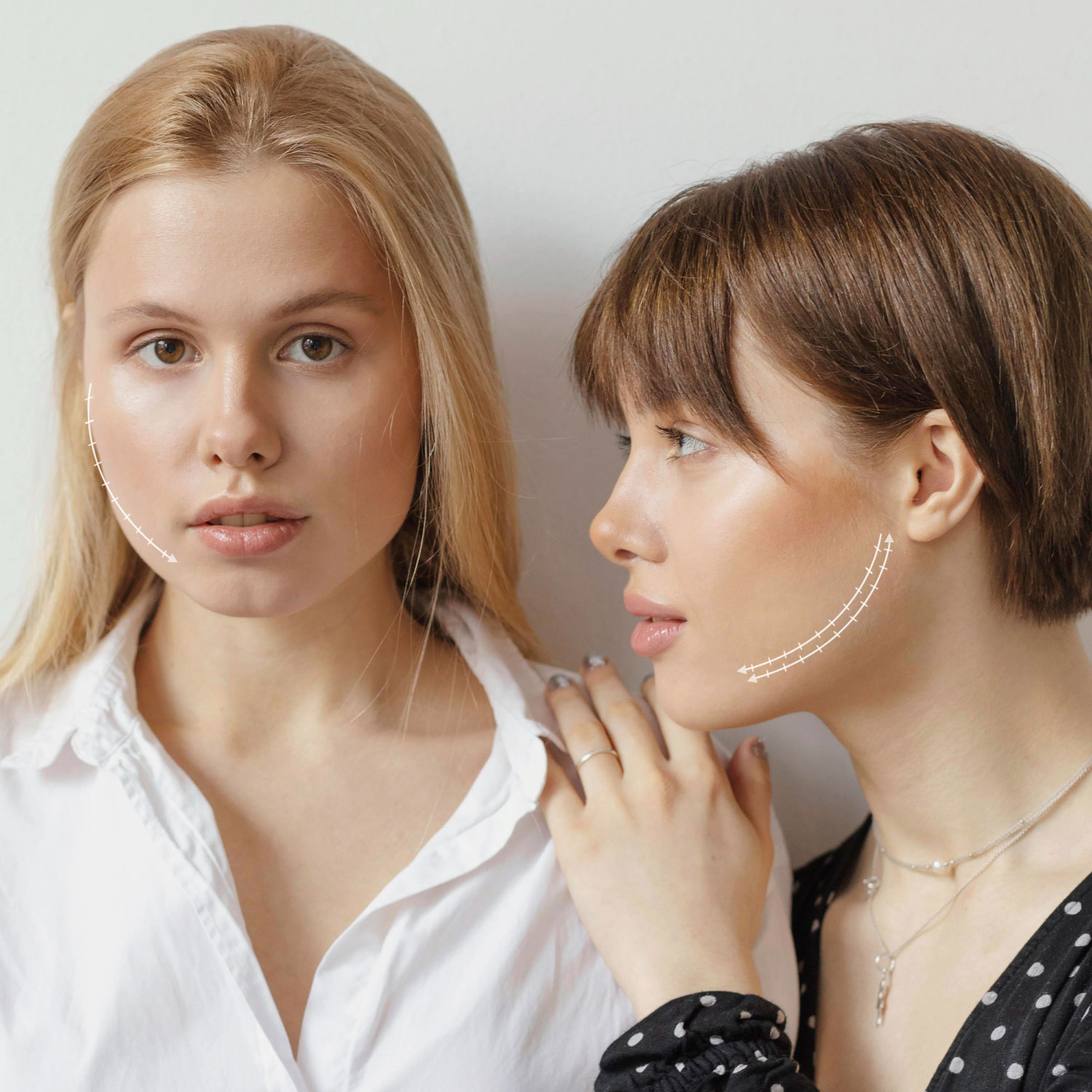 Контурная пластика подбородка