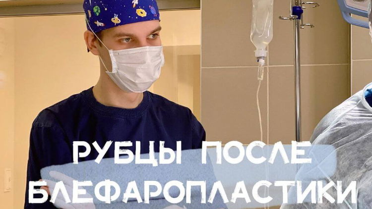 Будут ли заметны рубцы после блефаропластики?
