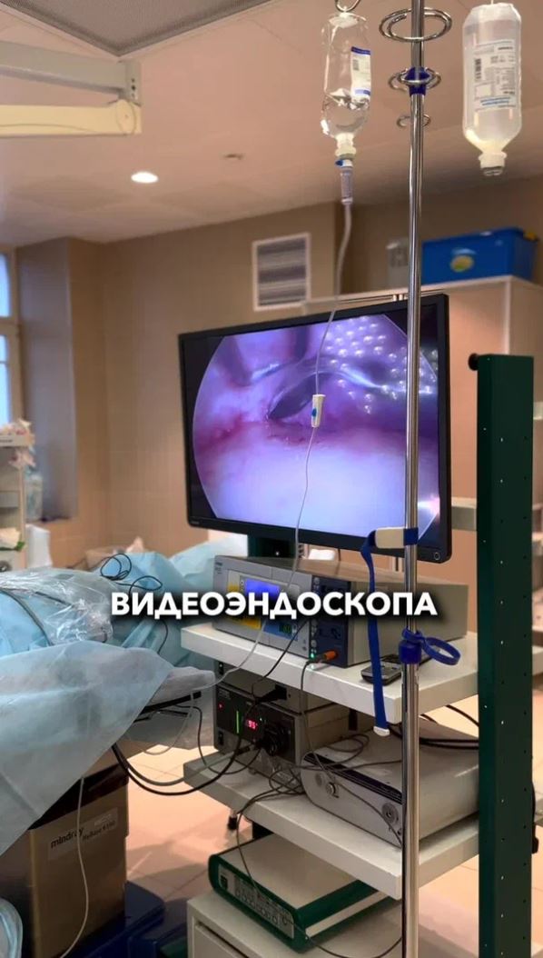 Золотов - после эндоскопическова лифтинга волосы не выпадают