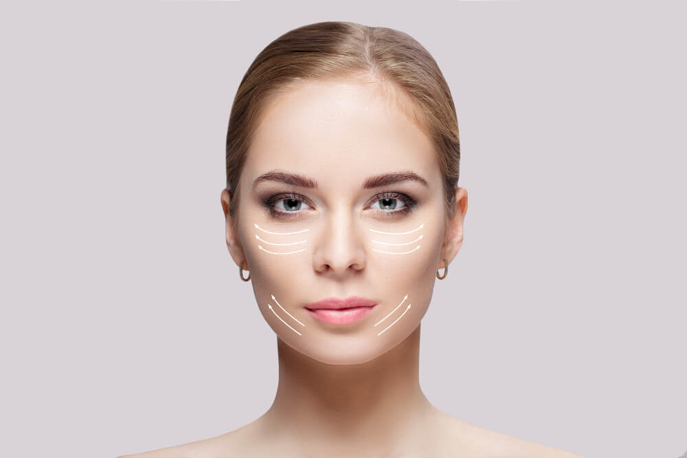 Монополярный рф-лифтинг Volnewmer