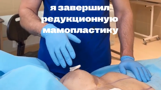 Выполнил пациентке редакционную маммопластику.