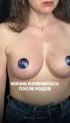 Не все говорят об этом вслух, но после родов...