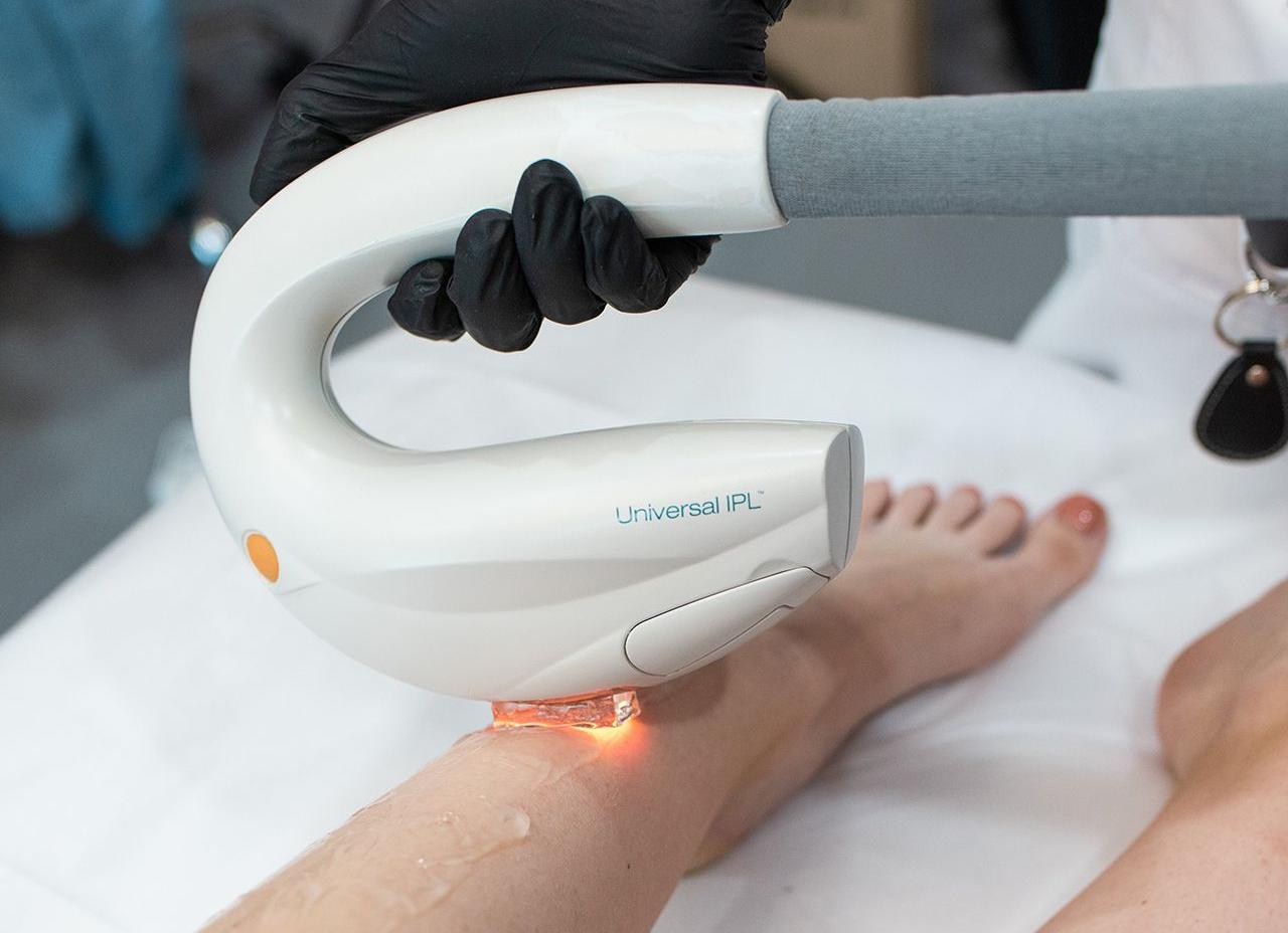 Преимущества фотоэпиляции