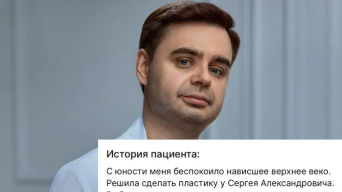 С юности меня беспокоило нависшее верхнее веко. Решила сделать пластику у Сергея Александровича. Выбирал