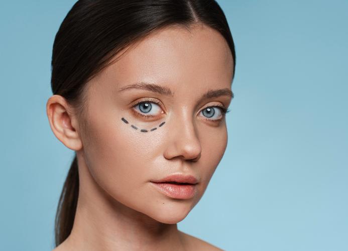 Пластика нижних век