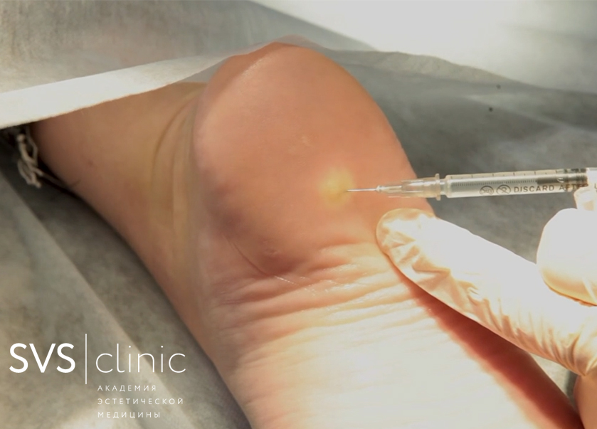 лазерная хирургия