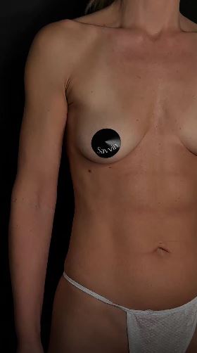 А вы тоже чувствуете, что грудь уже не как раньше?