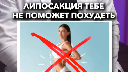 Липосакция не поможет похудеть