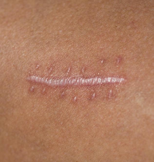 противопоказания