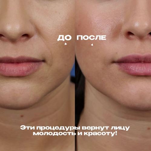 Что делать с этим валиком?