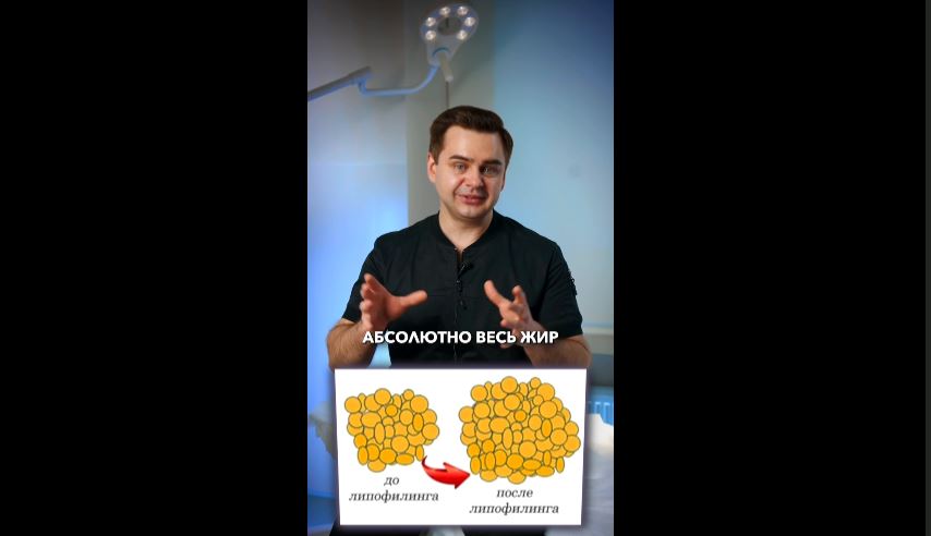 З - Липофилинг_14265