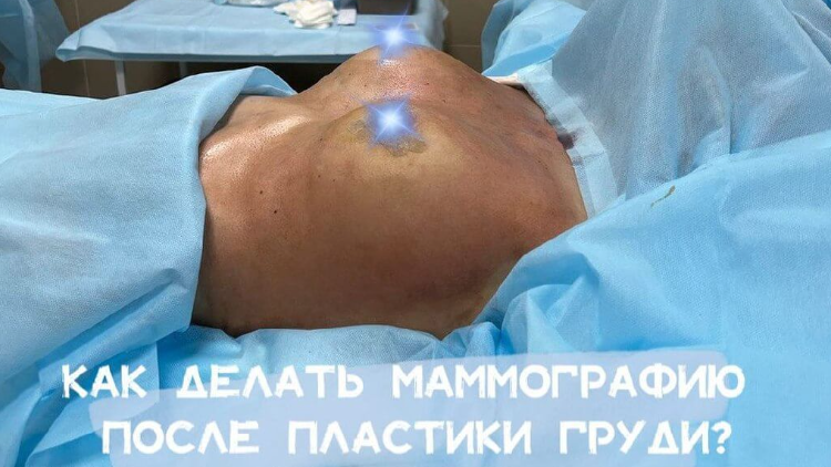 Как делать маммограму в будущем ?