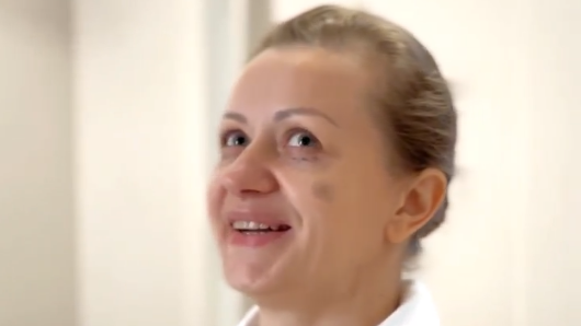 Помогаю свой пациентке "скинуть" лишние 10 лет. 