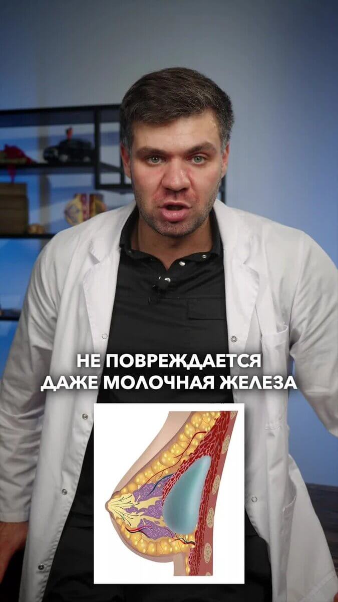 Беременность и установка импланта. Можно ли кормить грудью после маммопластики?