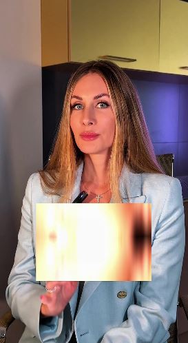 Почему же с возрастом усугубляется носогубная складка и образуется валик под ней?