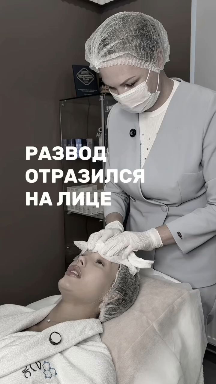 Биоревитализация зоны вокруг глаз препаратом Revi-Eye: от сухости и мелких морщин