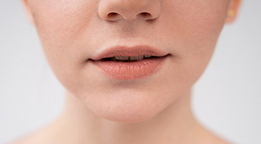 Носогубных складок