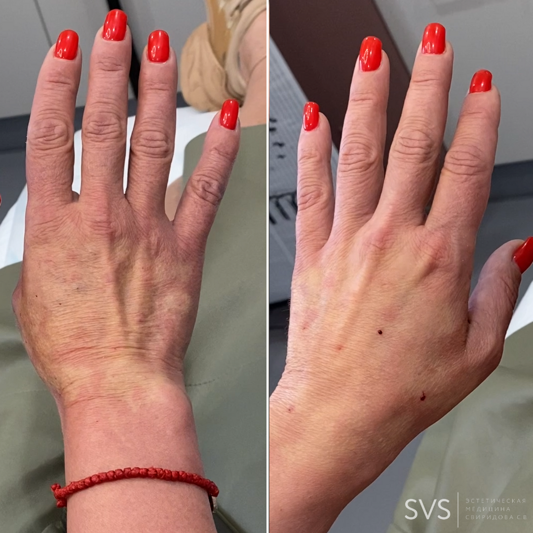 Руки, которые не выдают возраст!