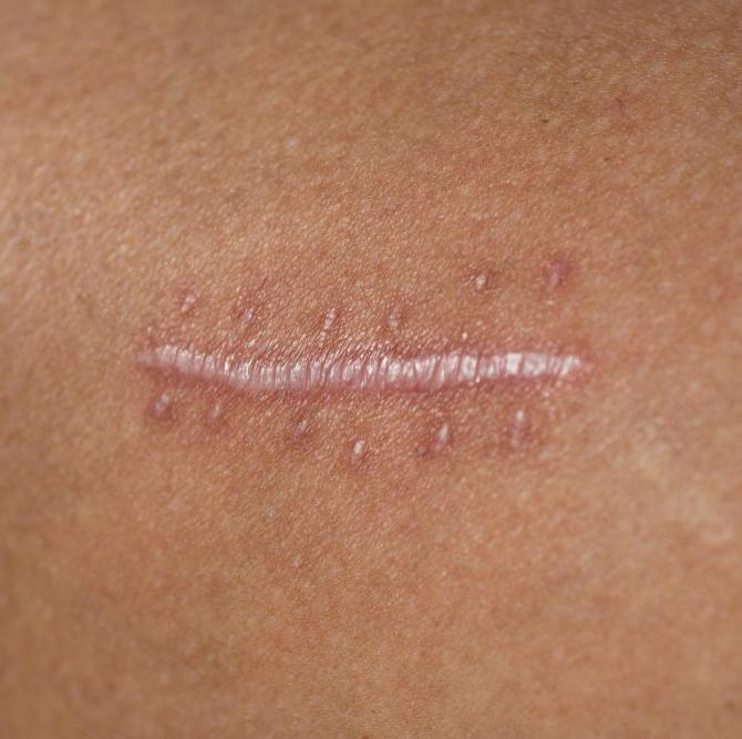 противопоказания