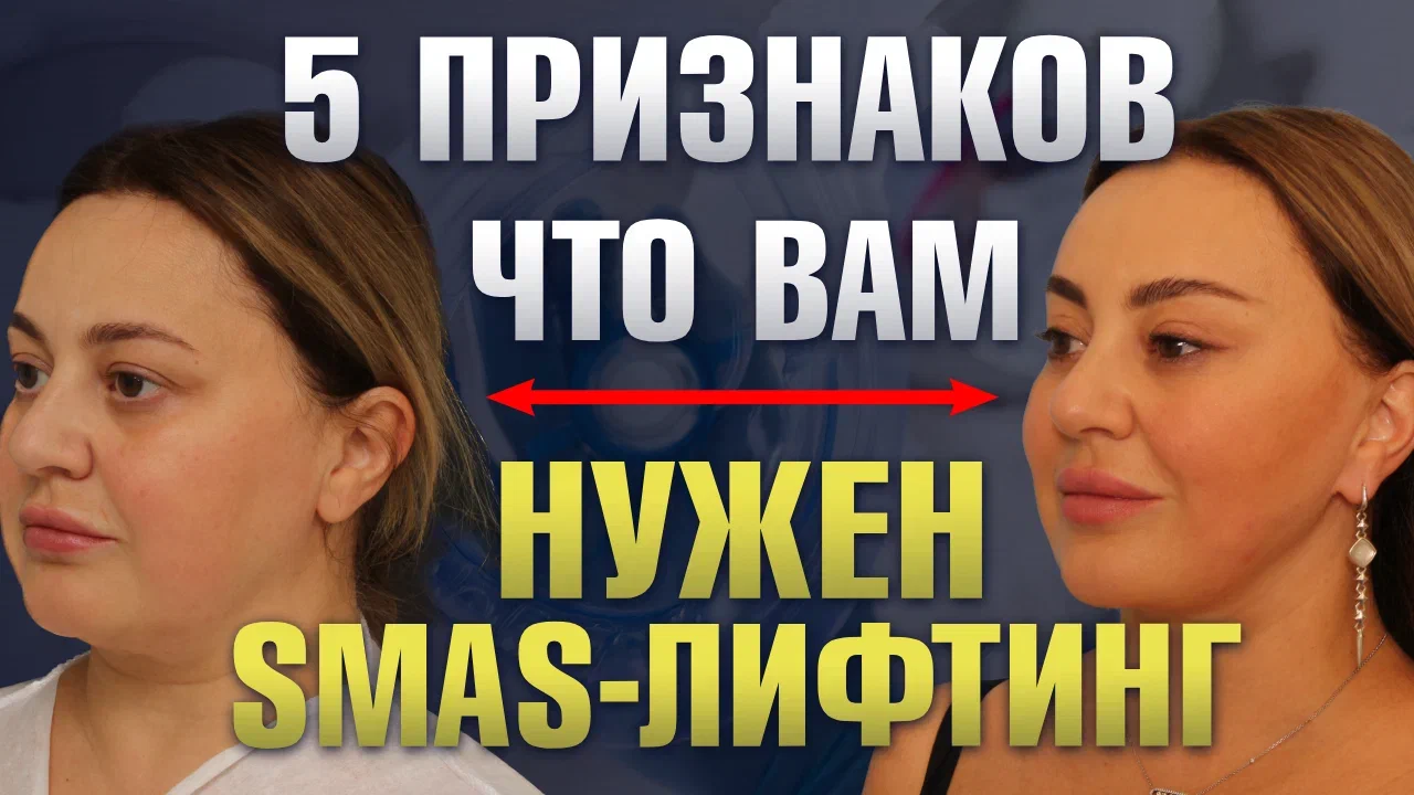 Сергей Свиридов - пластика в 40+