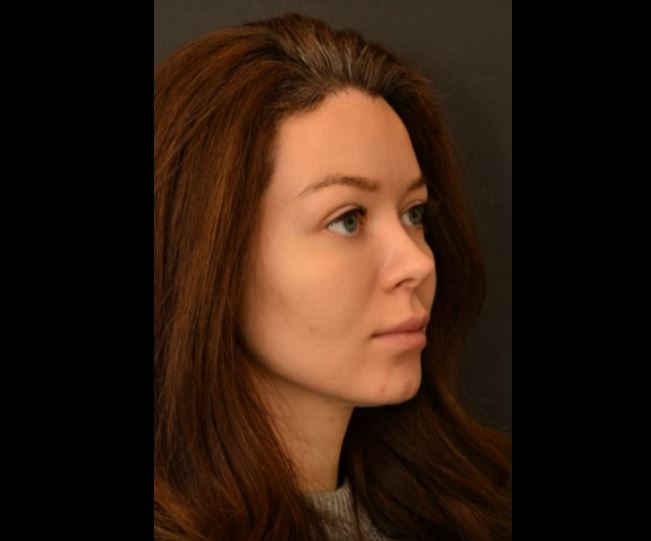 Для записи на консультацию пишите в директ!