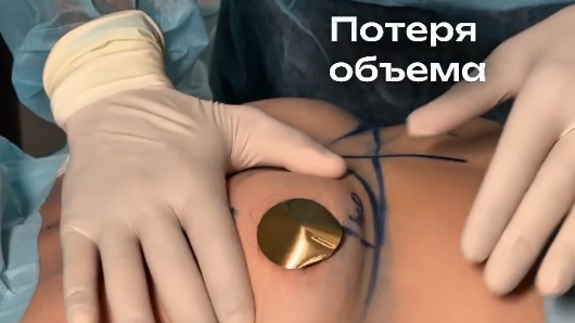 Для записи на консультацию пишите в директ!