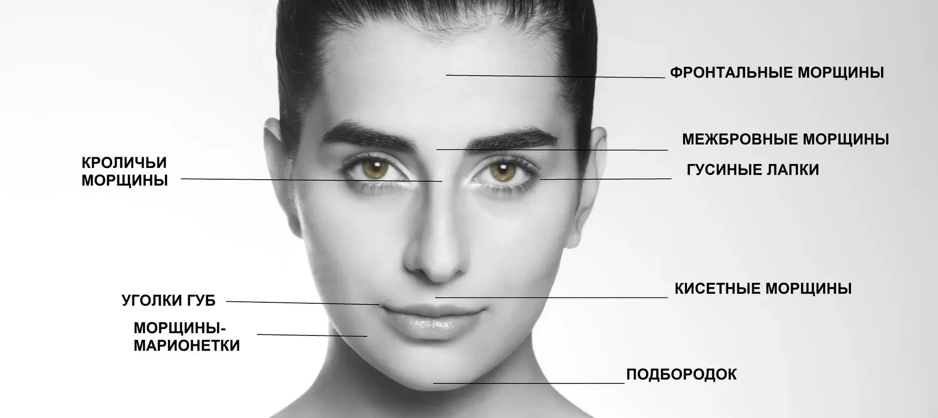 Ботулинотерапия