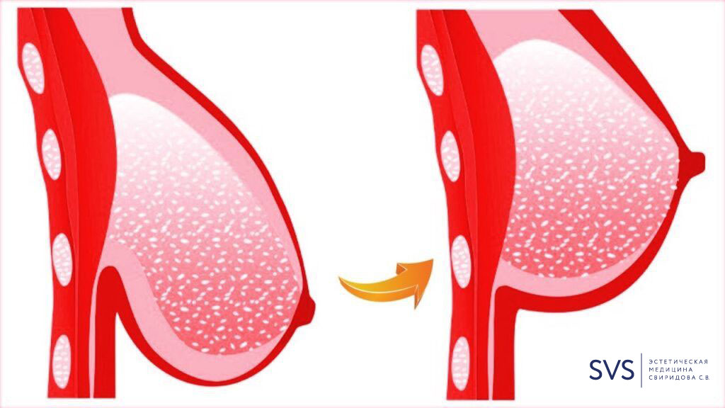 1568d3.jpg 1568d3.jpg