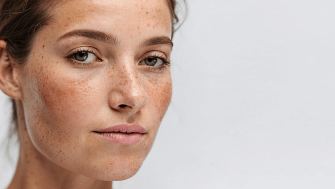 IPL омоложение