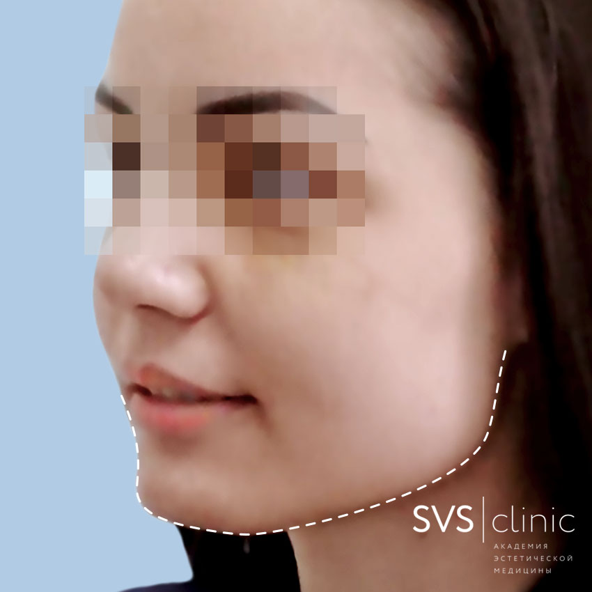 ДО подбородок профиль.jpg